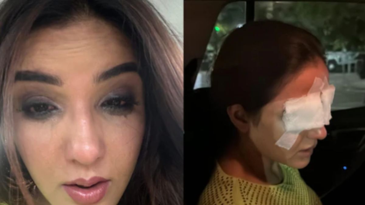 Jasmin Bhasin suffers serious eye injury! क्या कॉन्टैक्ट लेंस ने बिगाड़ दी जिंदगी? 😱👁️