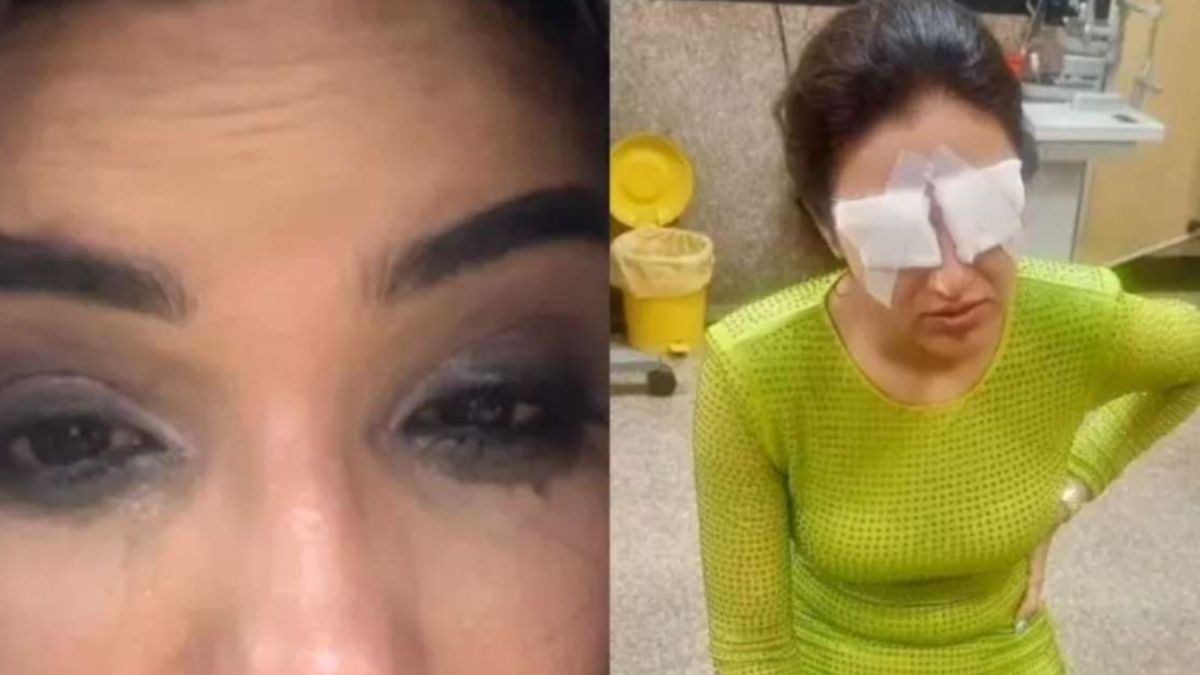 Jasmin Bhasin suffers serious eye injury! क्या कॉन्टैक्ट लेंस ने बिगाड़ दी जिंदगी? 😱👁️